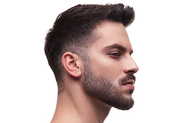 FTM Trans Beard Transplants | Dr. Anthony Bared