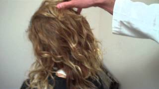 Female FUE (follicular unit extraction) Hair Case