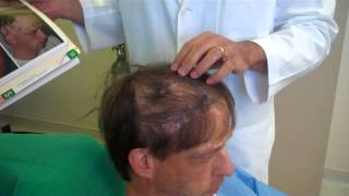 Hair Restoration