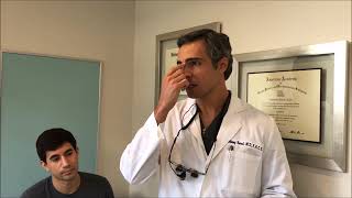 Male Rhinoplasty to reduce hump