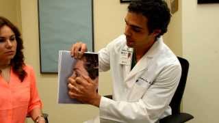 Plastic Surgery Miami: Rib Revision Rhinoplasty