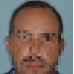 Hair Restoration Before and After Photos in Miami, FL, Patient 1694