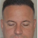 Hair Restoration Before and After Photos in Miami, FL, Patient 1733