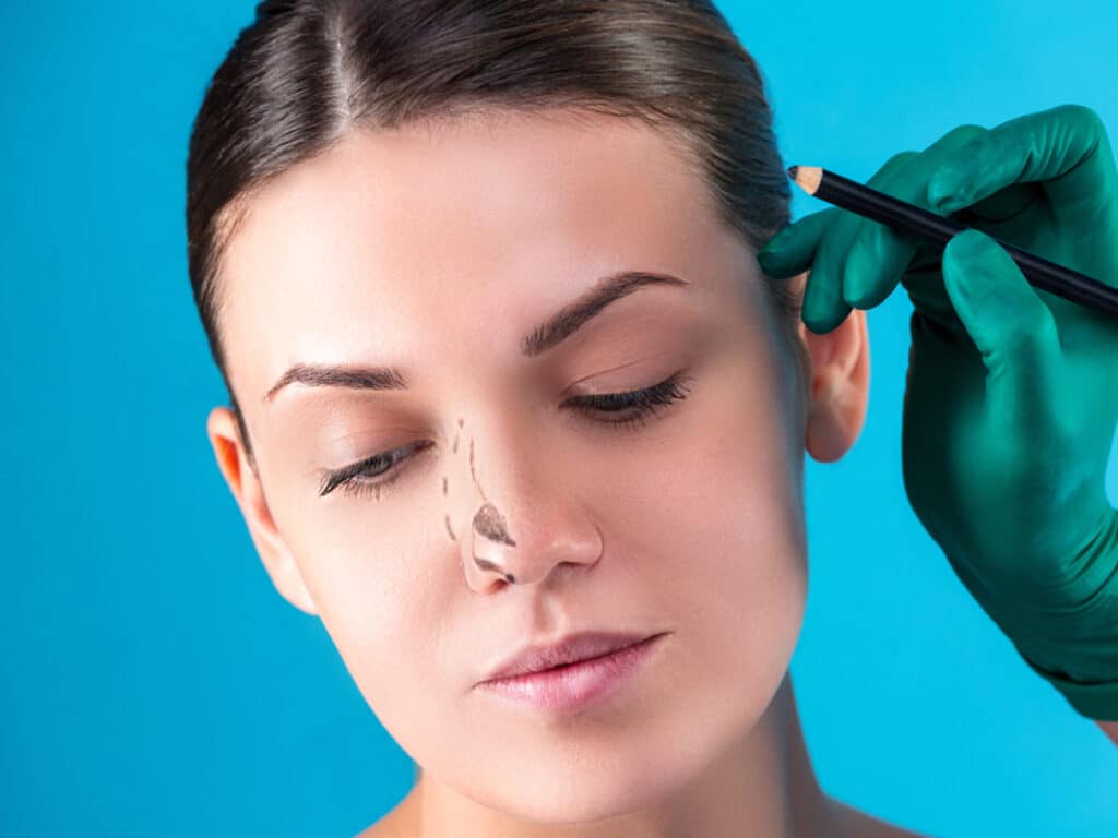 Rhinoplasty specialist Dr. Bared is highly experienced in harvesting and using rib cartilage for nasal surgery.