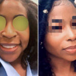 Ethnic Rhinoplasty Before and After Photos in Miami, FL, Patient 3557