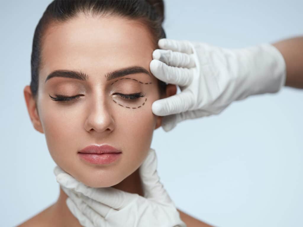 Patients considering blepharoplasty should look for a board-certified plastic surgeon with expertise in eyelid surgery to ensure the best possible outcome.