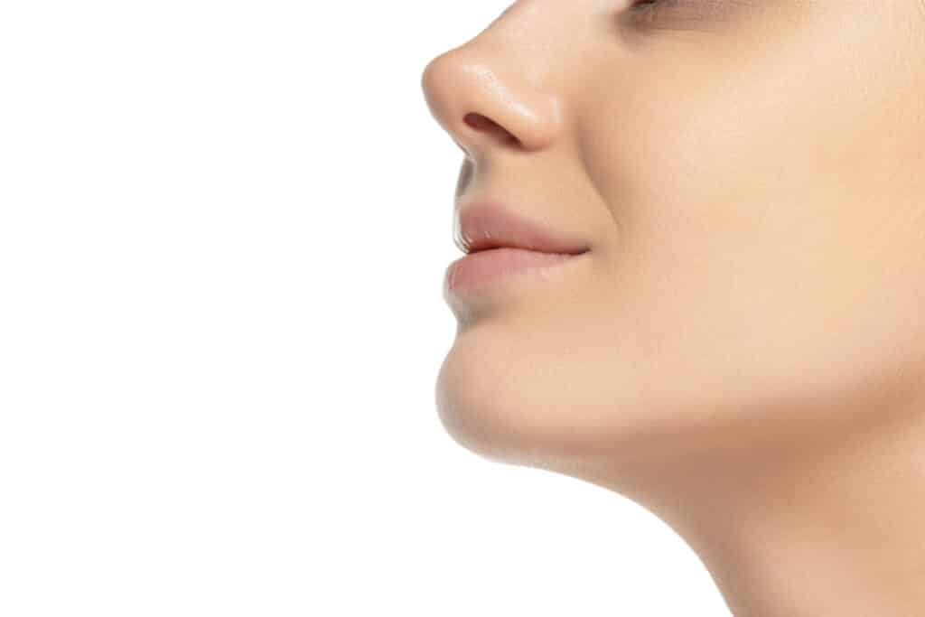 Bruising After Rhinoplasty Miami, FL