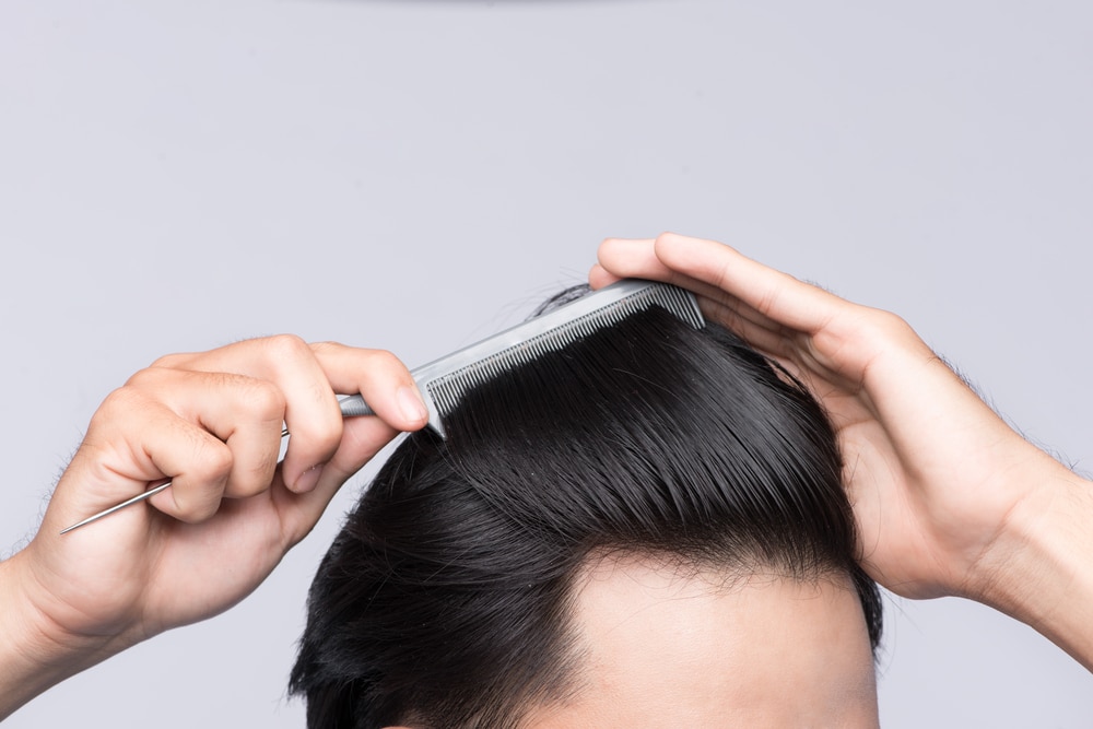 Hair Transplantation for Burn Scars in Miami, FL