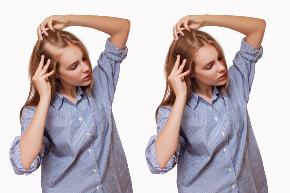 Woman examining her hair, considering the benefits of advanced hair transplant methods.