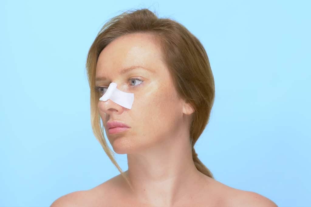 Limiting sun exposure and protecting the nose with sunscreen and hats can help minimize the risk of infections becoming more noticeable and aid in scar prevention.