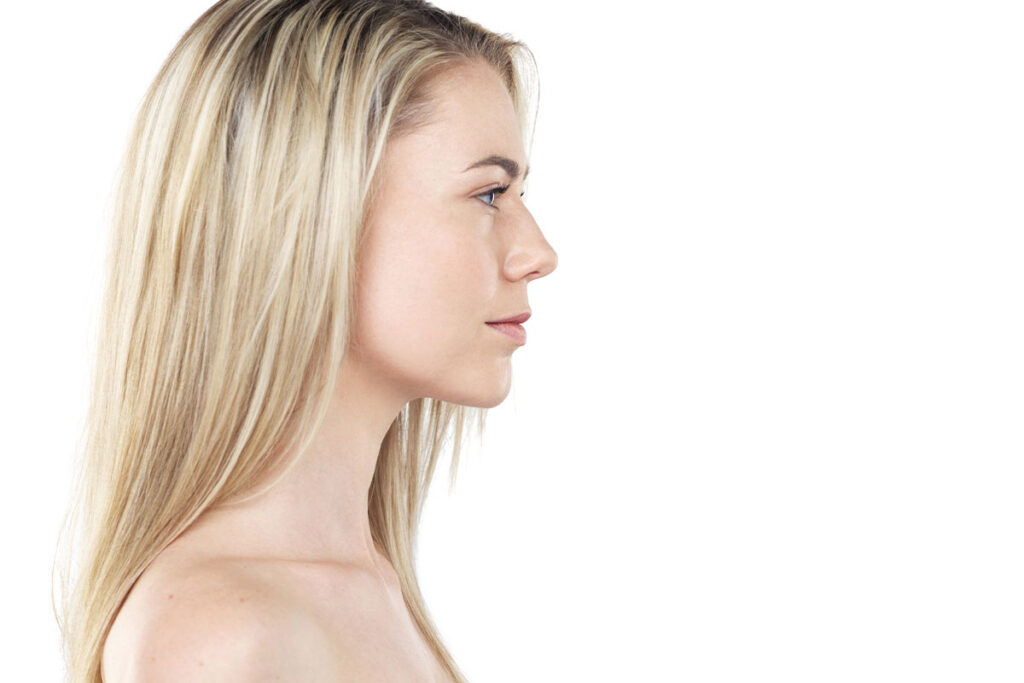 blog-the-truth-about-8-common woman after getting a rhinoplasty in Miami, FL