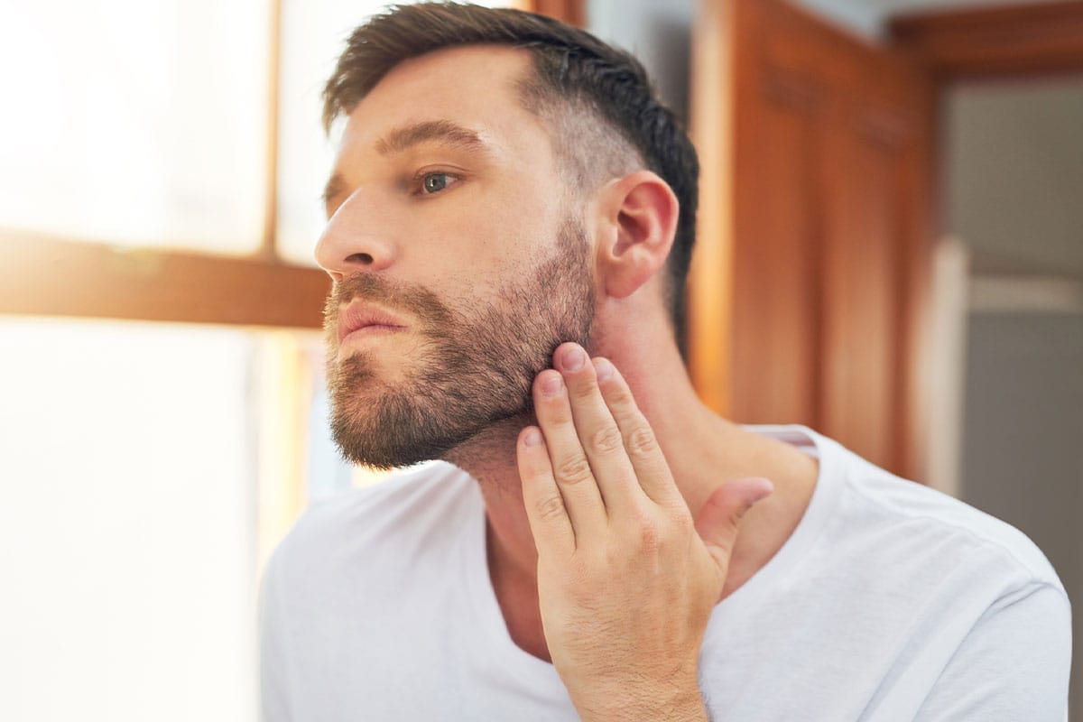 Considering a Beard Transplant? Key Things to Know First