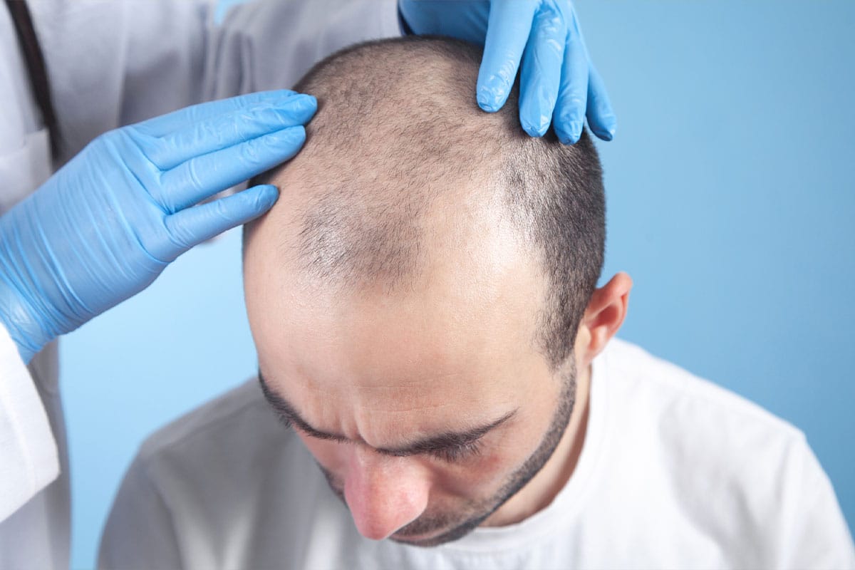 man and his doctor discussing a hair transplant in Miami, FL