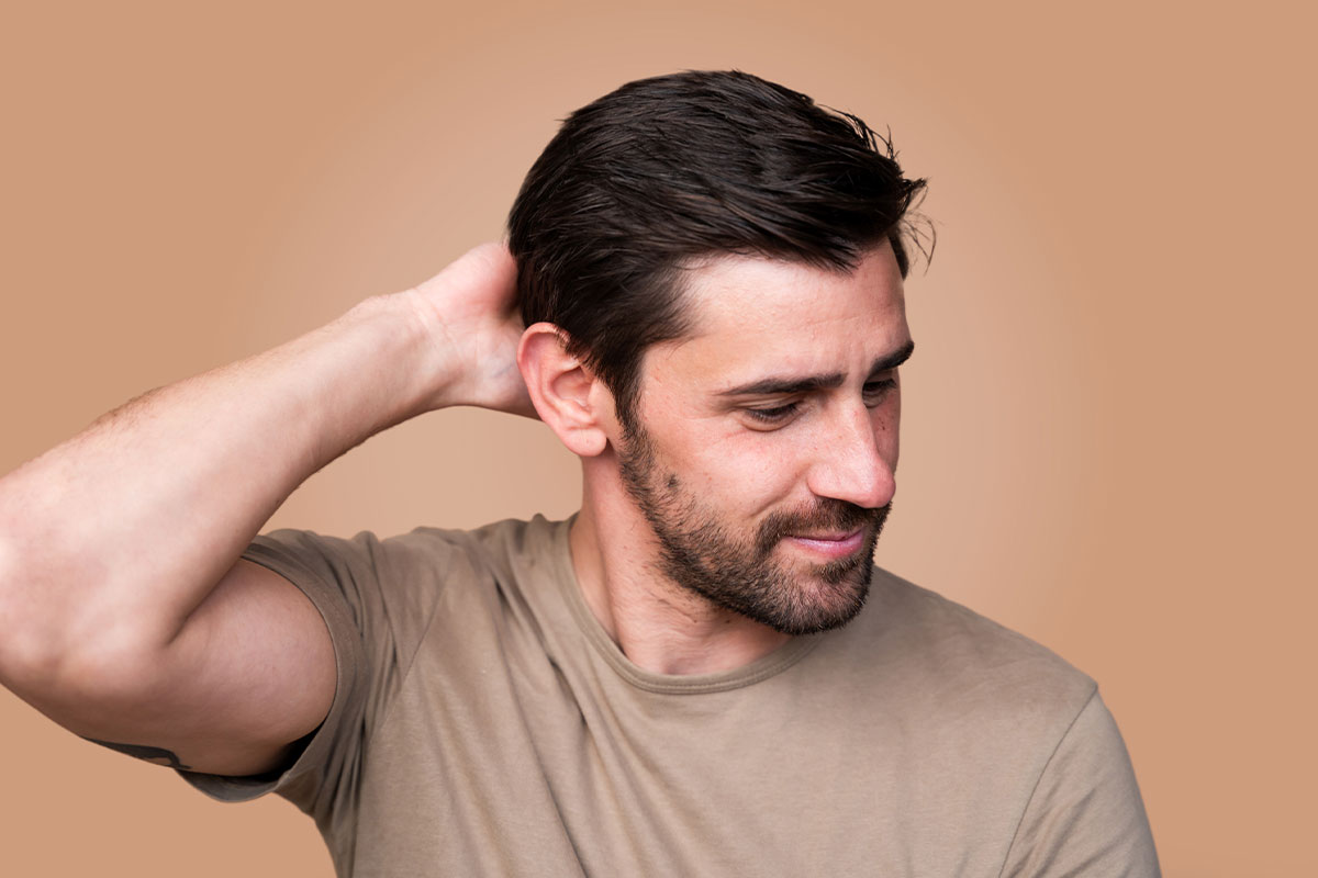 man after his hair transplant in Miami, FL